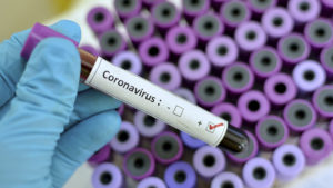 Общее число заболевших коронавирусом  в России составляет 59 человек