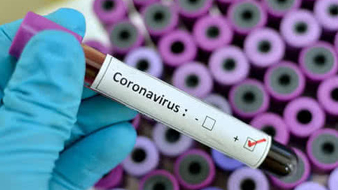 В России за сутки заразились коронавирусом 6060 человек