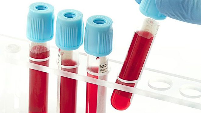 Ученые назвали наиболее устойчивую к раку группу крови