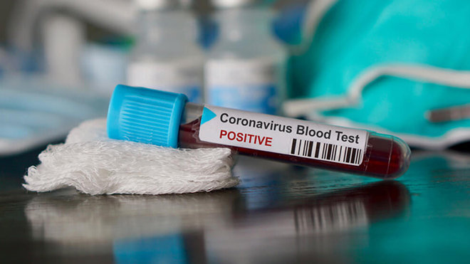 Количество зараженных коронавирусом в Украине растет с каждым днем: данные на утро 16 апреля